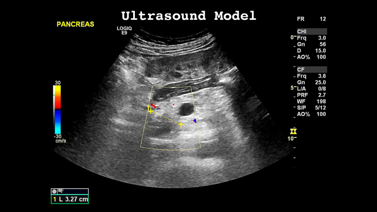 Ultrasound Model